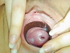Cervix orgasm