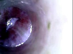 Full endoscope inside urethra of cock with ejac-inner adventure